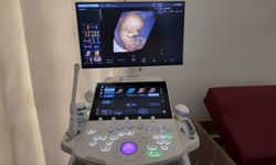 Kadın Doğum Kliniğine Yeni 4 Boyutlu Ultrasonografi Cihazı Kazandırıldı