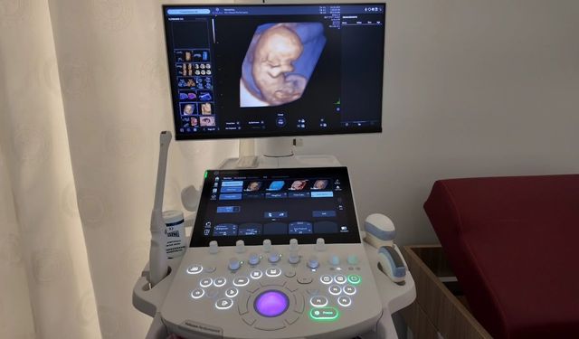 Kadın Doğum Kliniğine Yeni 4 Boyutlu Ultrasonografi Cihazı Kazandırıldı